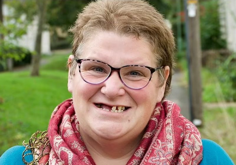 Британка си извади 13 зъба сама - не могла да стигне до зъболекар СНИМКА