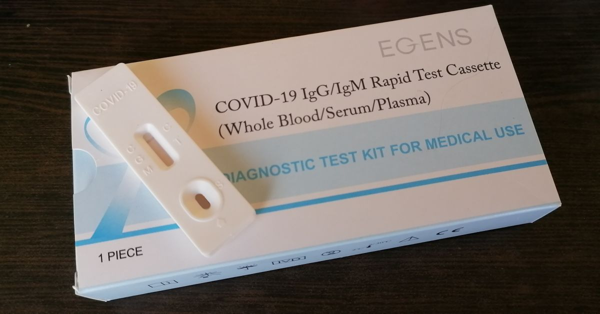 Горещи новини за антигенните ковид тестове
