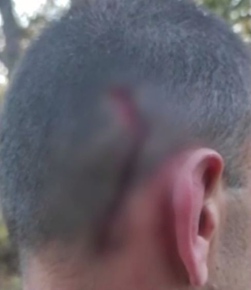 Демерджиев извади кървави СНИМКИ 18+ от екшъна с простреляния сириец 