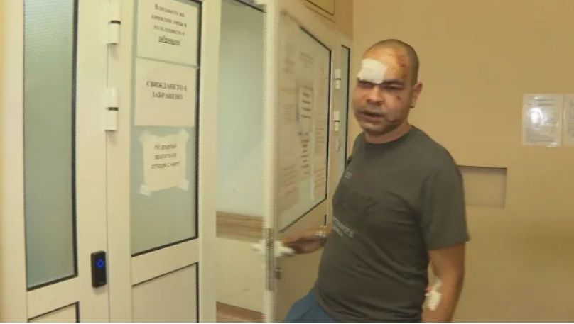 Шокиращи СНИМКИ на пребития медик във Враца: Избити са ми зъби, зашит съм на устната и челото 18+