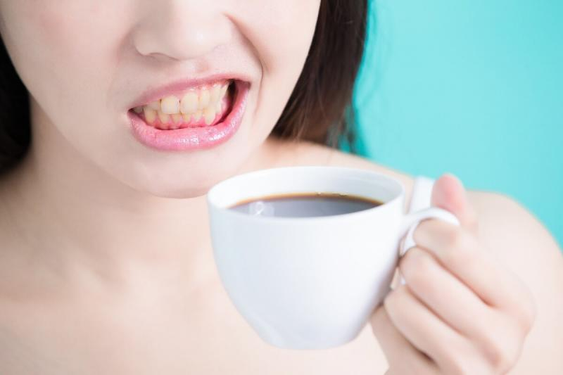 Никой зъболекар няма да ви каже тази тайна за лесно избелване на зъбите
