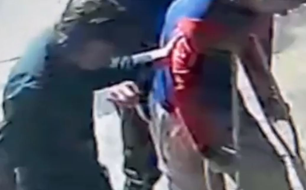 Грозно падение: Бабаити обраха посред бял ден момче с гипсиран счупен крак СНИМКИ 