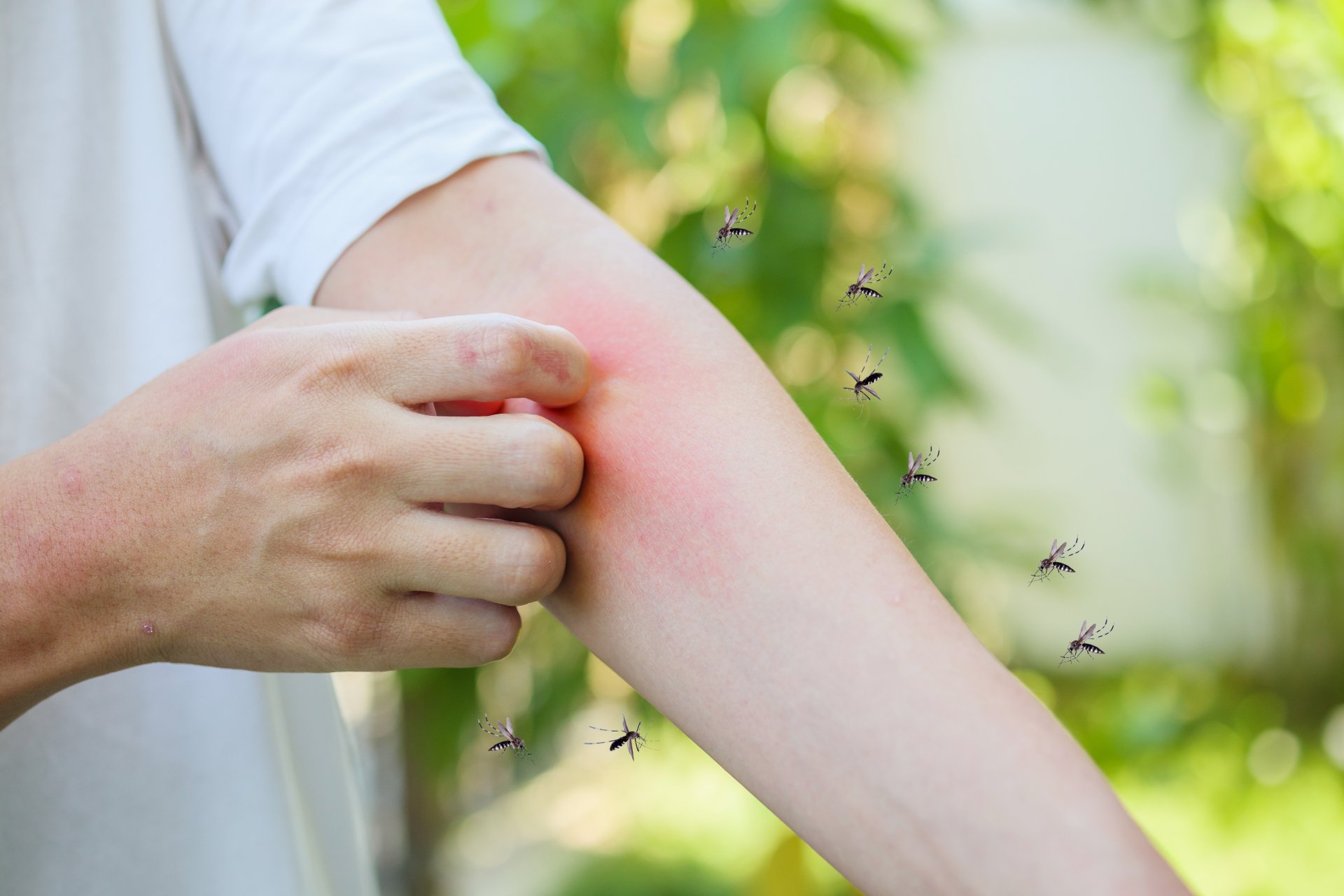 Ухапвания и ужилвания от насекоми - ето каква е разликата и как да намалим болката