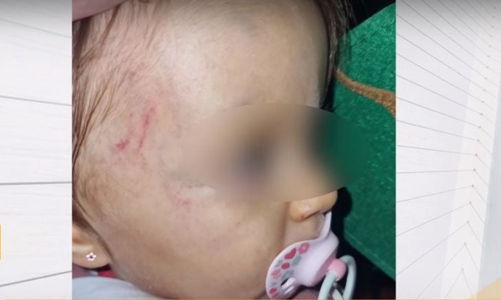 Скандално: Детски център върна 1-г. дете с кръвоизливи и синини по главата на майката ВИДЕО