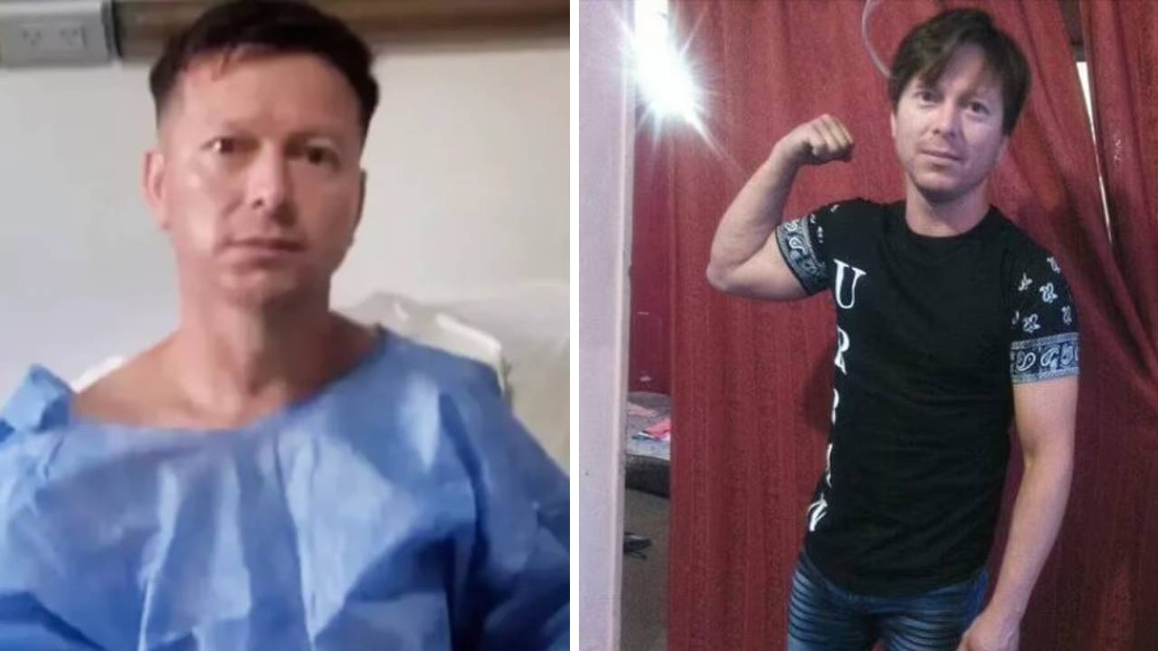 Ужасяващо: Разсеяни лекари скопиха Хорхе, вместо да оперират жлъчката му СНИМКА