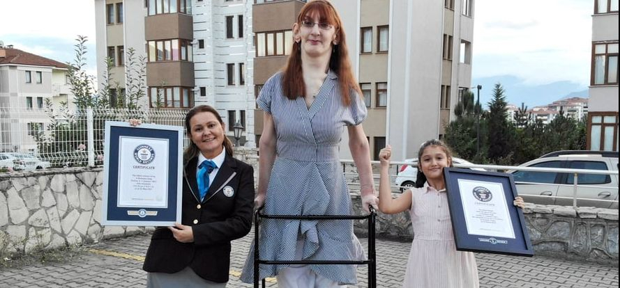 Странната болест на турското момиче, което бе признато за най-високата жена в света СНИМКИ