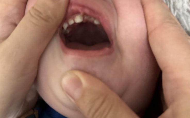 Избит зъб, кръв и синини: 2-г. момченце пострада в „Малката русалка“