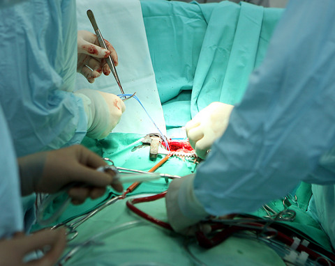 В Косово разкриха клиника за незаконни бъбречни трансплантации
