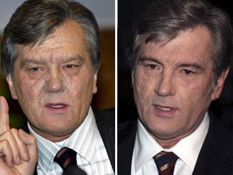 Организмът на Юшченко се е изчистил от диоксина