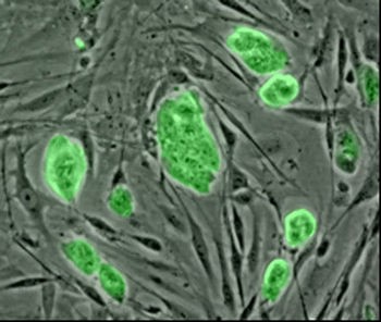 Изследванията на стволовите клетки са аморални