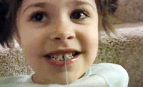 Нов начин за вадене на млечен зъб: количка с дистанционно 