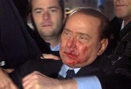 След побоя Берлускони поискал първо да изчете пресата - ВИДЕО