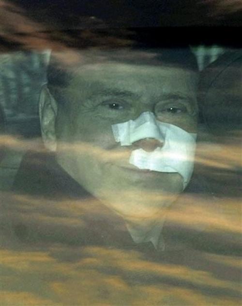 Изписаха Берлускони, ще си почива в Швейцария