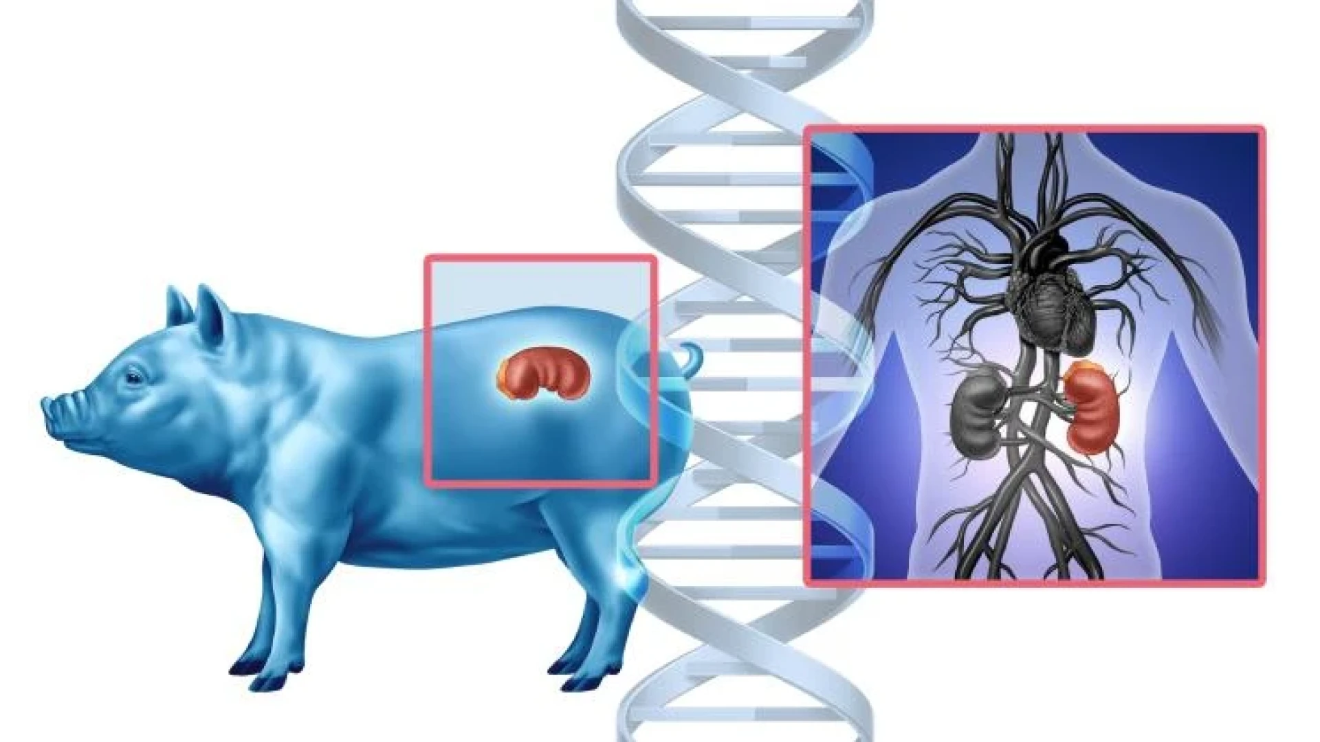 Живоотспасяващо: Трансплантираха ГМО бъбрек от прасе на жена!