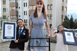 Странната болест на турското момиче, което бе признато за най-високата жена в света СНИМКИ
