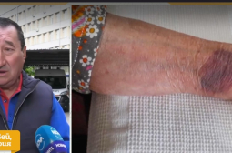 Брутално: 104-годишна пациентка е връзвана за леглото във видинска болница и... ВИДЕО