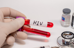 Три жени отидоха на козметик и се оказаха заразени с ХИВ 