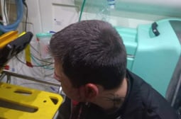 Масов бой с разбити глави в Габрово, има арестувани СНИМКА