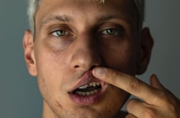 Див екшън в Пловдив: Охранители потрошиха от бой певец, счупиха му зъбите СНИМКИ 18+