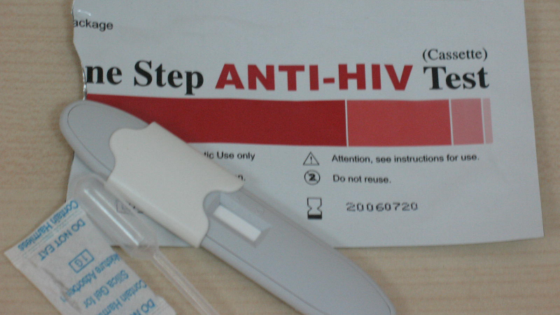 171 нови случая на ХИВ у нас