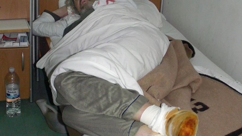 Мъж с премръзнали крака почина в болницата в Хасково