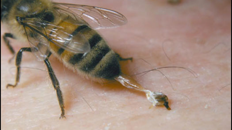 В Пекин лекуват с ужилване на пчела