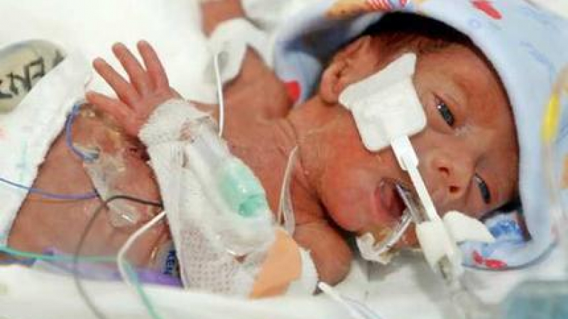 Оперираха 500-грамовото бебе на 62-годишната Красимира
