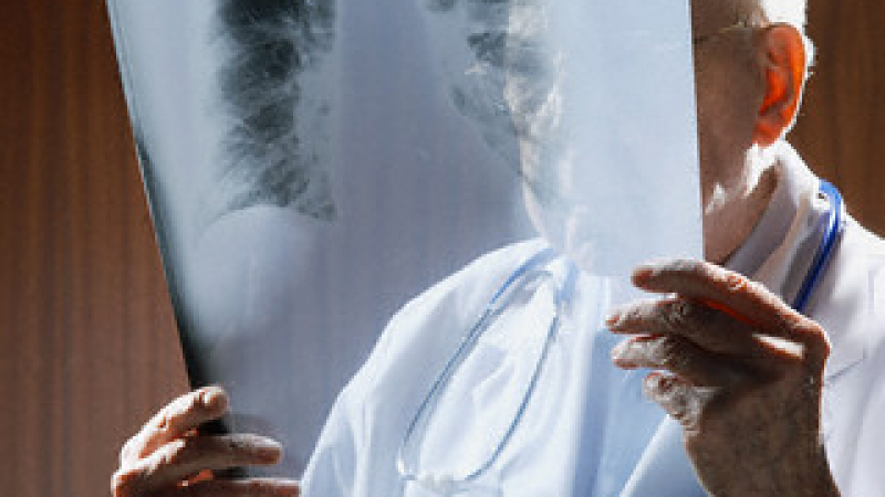 Доц. Коста Костов: Всеки ден 10 българи умират от болести на дихателната система