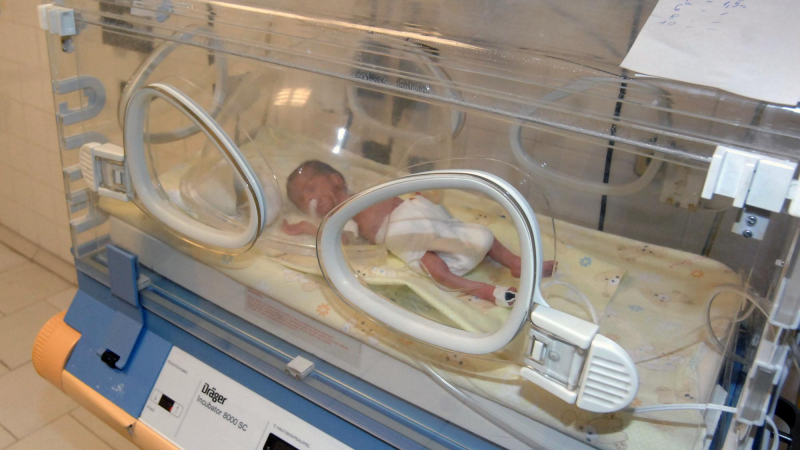 Роди се бебе с половин мозък в Бургас