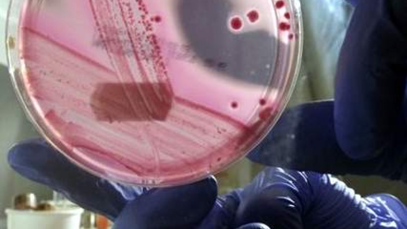 Опасната ешерихия коли бактерия разболява повече жени!
