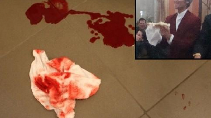 Ромски лидер наръга съпругата си с нож в гърба