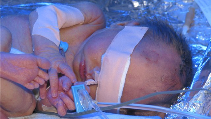 Тримесечно бебе изгоря в Лом заради незагасен фас на батковците си