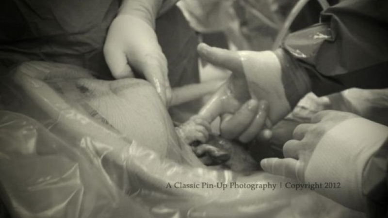 Чудо! Бебе излиза от корема на майка си и хваща ръката на лекаря (ВИДЕО) 
