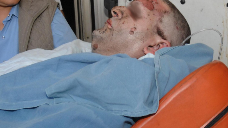 Жена разби черепа на мъж при пиянска кавга 