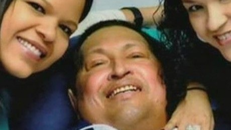 Уго Чавес е в съзнание, но загуби говора си