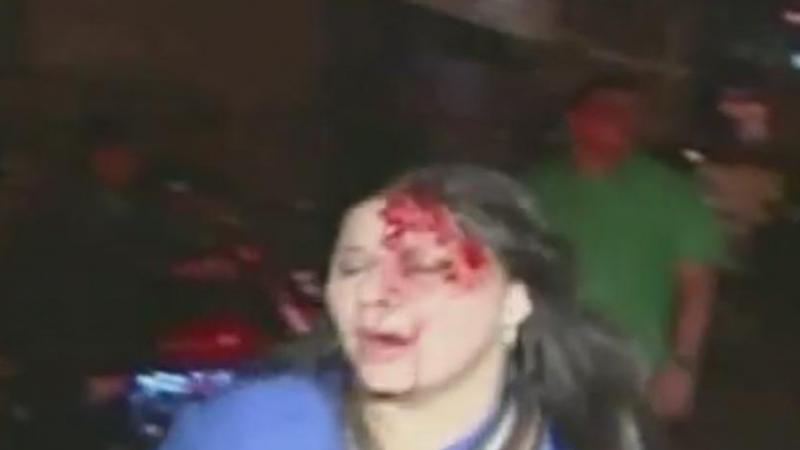 Вижте пребитата журналистка, съобщила за кончината на Чавес (ВИДЕО)