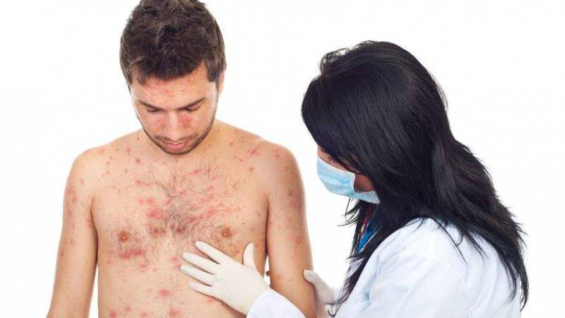 Алергията възниква и към нереални дразнители