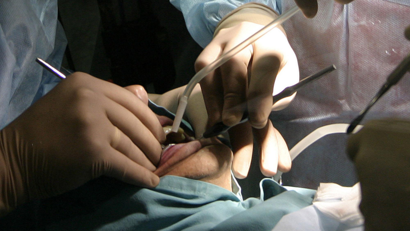 Прокуратурата погна зъболекар, източил Здравна каса с фалшиви пломби
