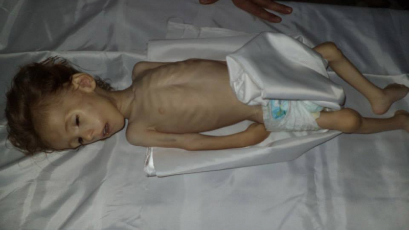 Деца гладуват до смърт заради кризата в Сирия 