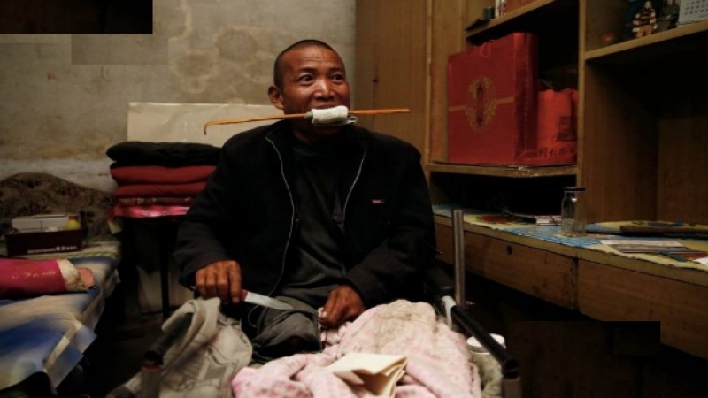 Китаец си ампутира крака с пила, нямал пари за лекар