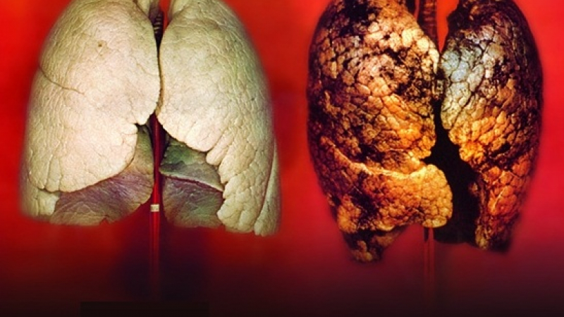 Мръсният въздух разболява от рак на белите дробове