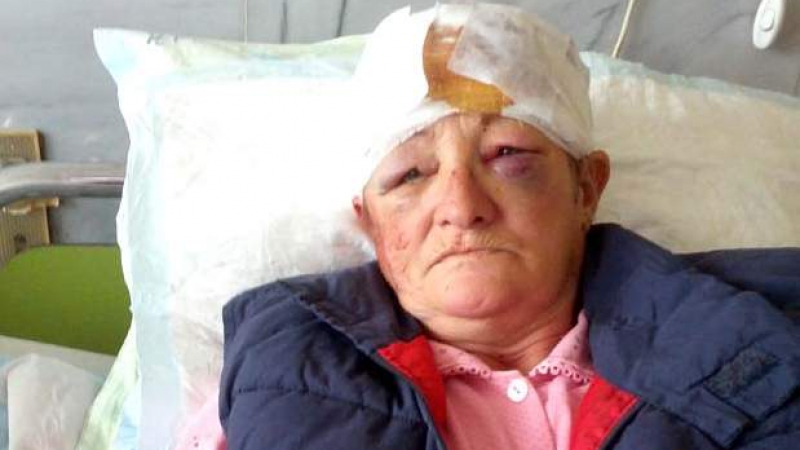 Лидия оцеля с 97 шева на главата и счупен череп, побойничката й е на свобода