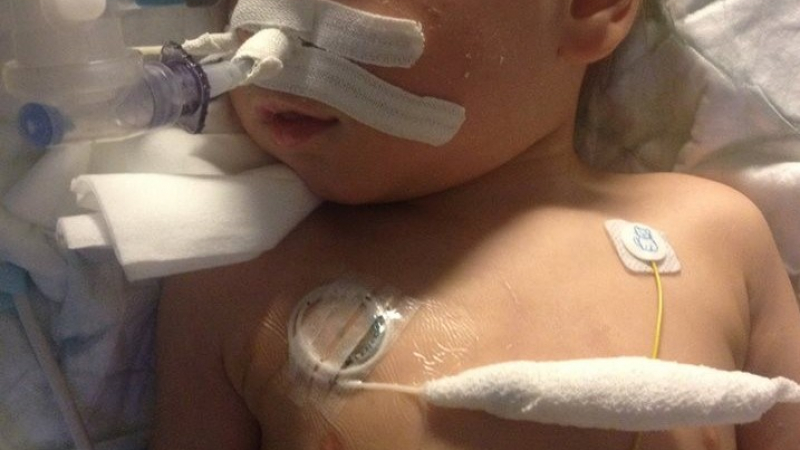 Момченце на 2 годинки вдиша ядки и изпадна в кома