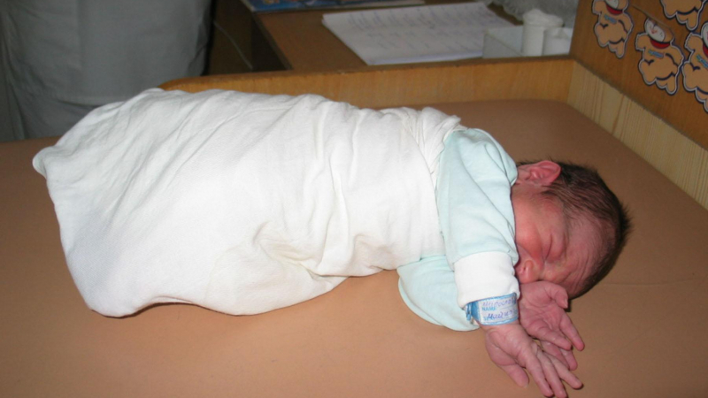 Изродиха със секцио шестото бебе на 160-килограмова родилка 