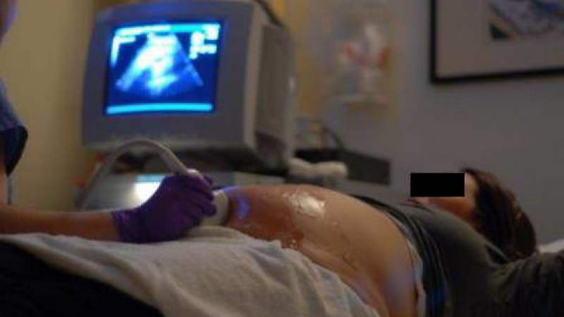 Жена се оказа бременна след направен в болница аборт! 