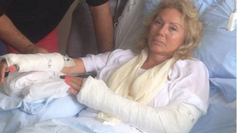 Счупването на ръцете на Лепа Брена застрашавало живота й (СНИМКИ)