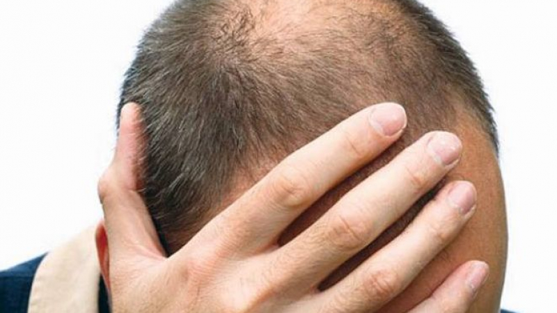 Лекарство възстановява растежа на коса при един вид оплешивяване