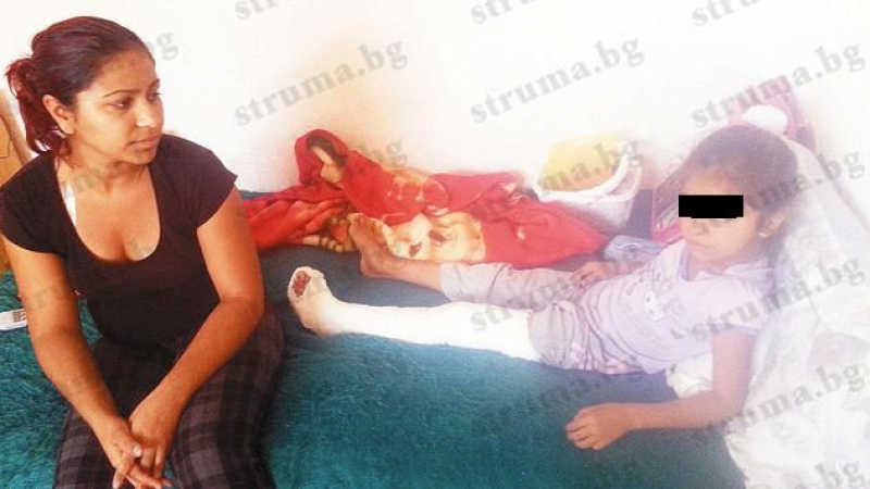 Майка: Такси бутна дъщеря ми, кракът й е счупен на 2 места, шофьорът отказва да помогне 