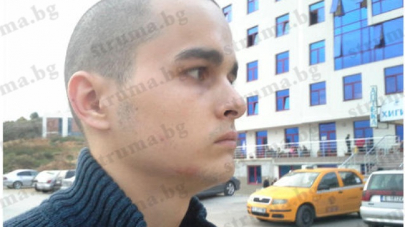 Племеник на президента арестуван и бит от полицаи в Благоевград