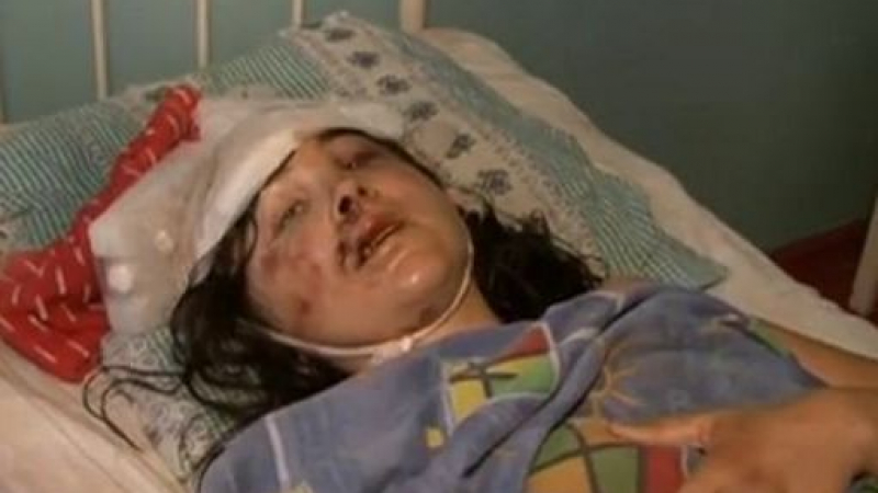 Мъж преби жена си, приеха я в болница със счупен череп